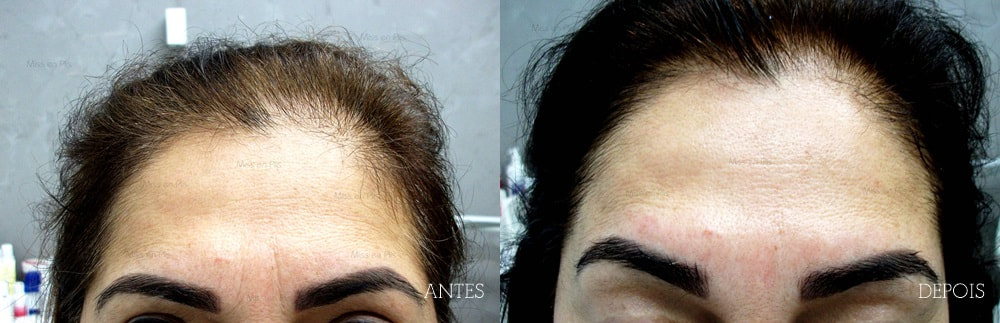 ESTÉTICA DE RESULTADO AO SEU ALCANCE