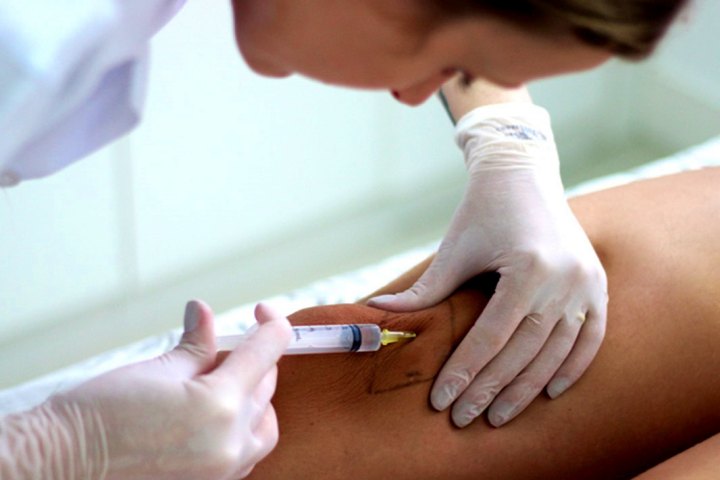 APLICAÇÃO DE ENZIMAS PARA GORDURA LOCALIZADA PREÇO