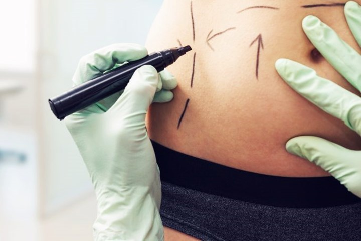 APLICAÇÃO DE ENZIMAS PARQUE DA MOOCA