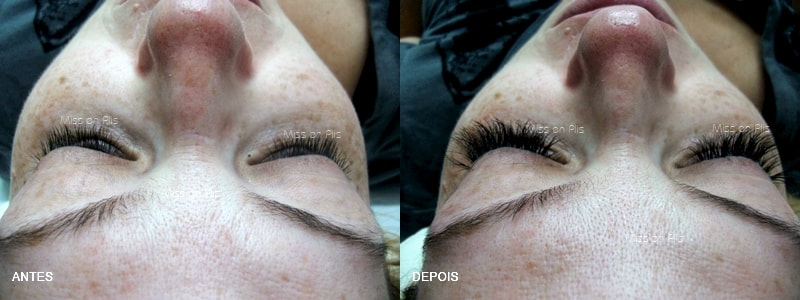 Cílios fio a fio : antes e depois