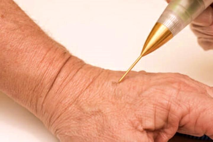 JATO DE PLASMA EM SÃO PAULO