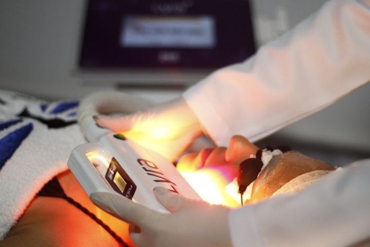 DEPILAÇÃO A LASER NO SACOMÃ