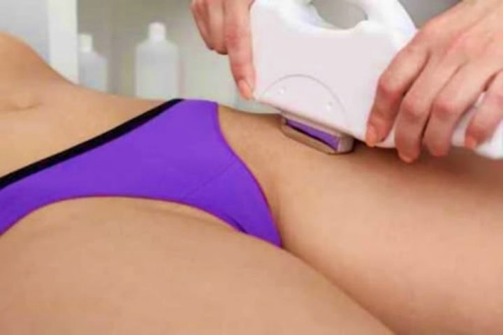 DEPILAÇÃO A LASER VIRILHA COMPLETA