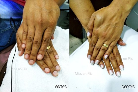 unhas de fibra de vidro antes e depois