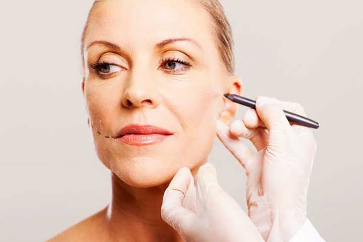 FIO DE SUSTENTAÇÃO NO ROSTO