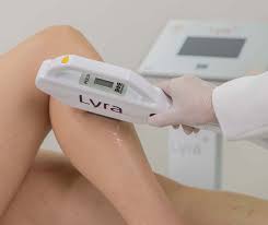 DEPILAÇÃO A LASER AXILA