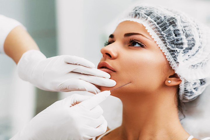 HARMONIZAÇÃO FACIAL DURAÇÃO