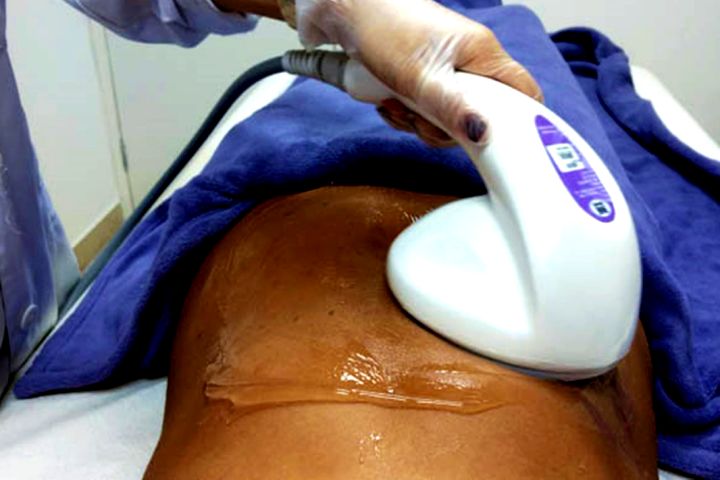 HIDROLIPO NÃO ASPIRATIVA DÓI?