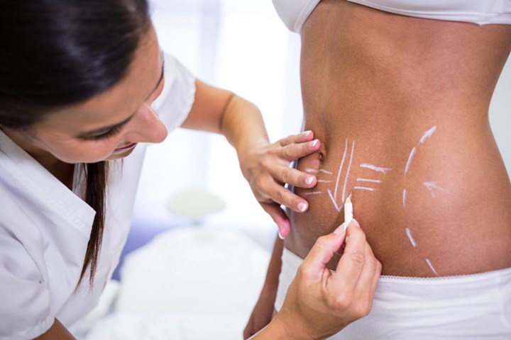 HIDROLIPO NÃO ASPIRATIVA VALOR