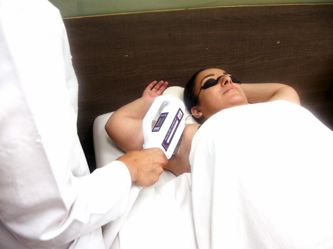 DEPILAÇÃO LASER NO TATUAPÉ