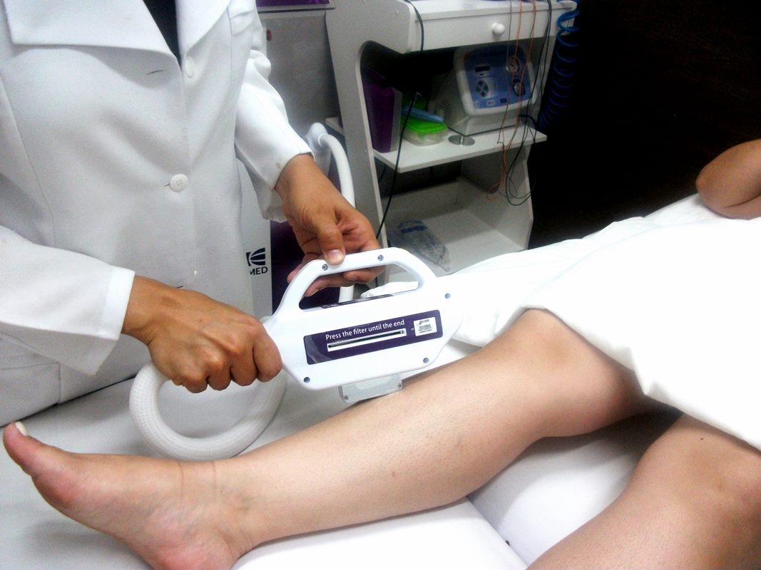 DEPILAÇÃO LASER NA VILA PRUDENTE