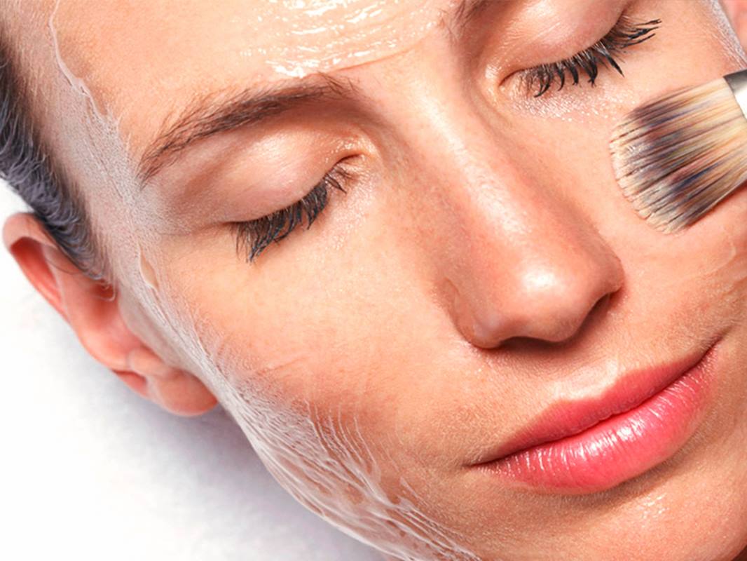 PEELING QUÍMICO VILA ZELINA