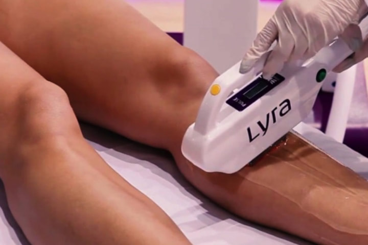 PREÇOS DE DEPILAÇÃO A LASER