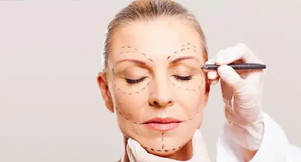 PREENCHIMENTO DE OLHEIRAS NO JARDIM INDEPENDÊNCIA