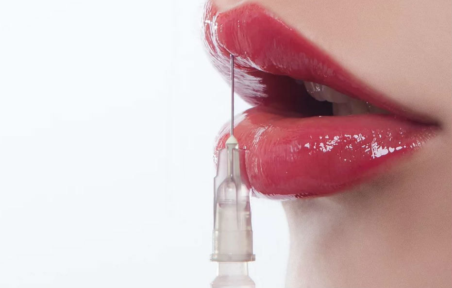 PREENCHIMENTO LABIAL EM SÃO PAULO