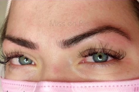 MICROBLANDING FIO A FIO VALOR