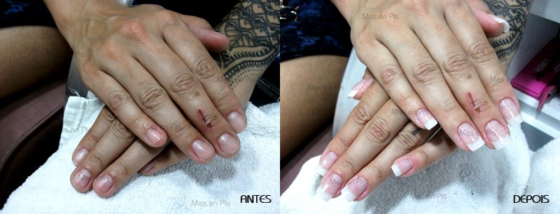 unhas de porcelana antes e depois